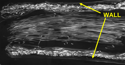 Imagem de microscopia eletrónica de varrimento que mostra uma secção longitudinal de um conduto de seda contendo fibras luminais de seda que orientam o crescimento nervoso. Imagem de Newrotex Ltd